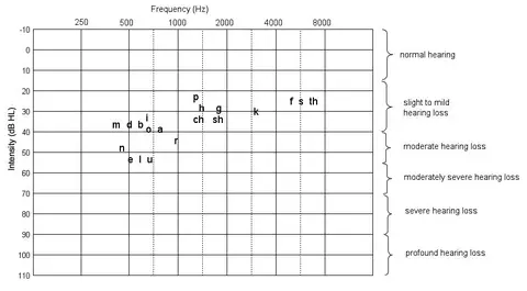Audiogram sounds and categories